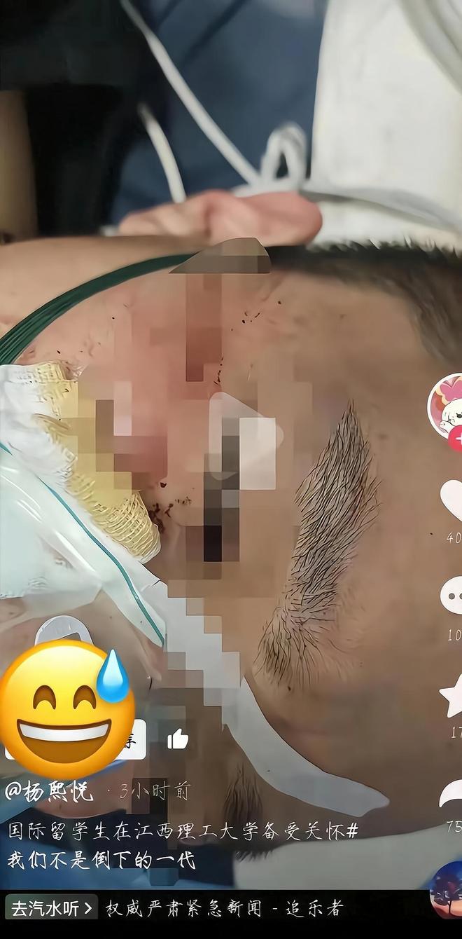 后续当事人发声留学生的拳头砸痛了谁的心PG麻将胡了网站入口江西理工外籍生打人(图19)