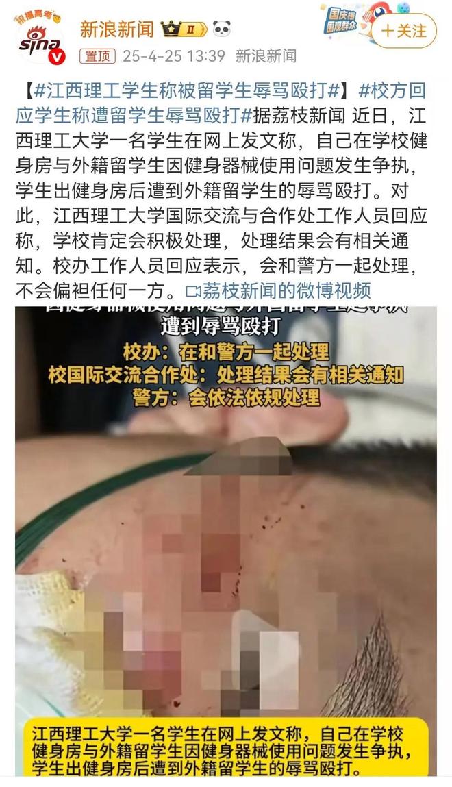 后续当事人发声留学生的拳头砸痛了谁的心PG麻将胡了网站入口江西理工外籍生打人(图17)